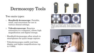Basics of Dermoscopy seminar by dr akshata soni | PPTX