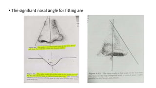 • The signifiant nasal angle for fitting are
 