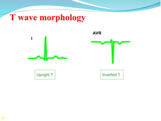 The basics of ECG and its interpretation | PPT