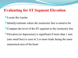 Evaluating for ST Segment Elevation
Locate the J-point
Identify/estimate where the isoelectric line is noted to be
Compare the level of the ST segment to the isoelectric line
Elevation (or depression) is significant if more than 1 mm
(one small box) is seen in 2 or more leads facing the same
anatomical area of the heart
 
