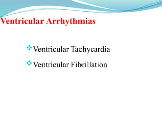 Ventricular Arrhythmias
Ventricular Tachycardia
Ventricular Fibrillation
 