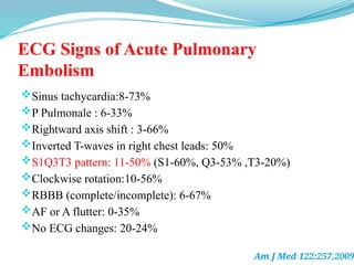 ECG Signs of Acute Pulmonary
Embolism
Sinus tachycardia:8-73%
P Pulmonale : 6-33%
Rightward axis shift : 3-66%
Inverted T-waves in right chest leads: 50%
S1Q3T3 pattern: 11-50% (S1-60%, Q3-53% ,T3-20%)
Clockwise rotation:10-56%
RBBB (complete/incomplete): 6-67%
AF or A flutter: 0-35%
No ECG changes: 20-24%
Am J Med 122:257,2009
 