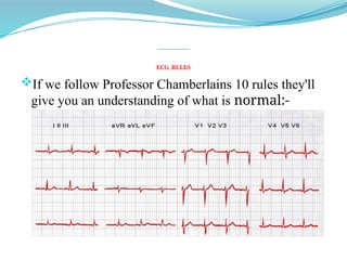 ECG RULES
If we follow Professor Chamberlains 10 rules they'll
give you an understanding of what is normal:-
 