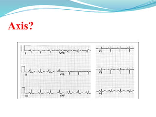 Axis?
 