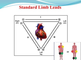 Standard Limb Leads
 