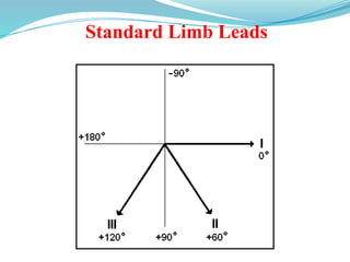 Standard Limb Leads
 
