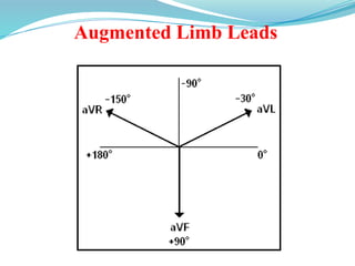Augmented Limb Leads
 