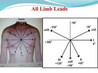 All Limb Leads
 