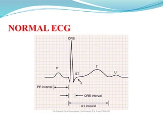 NORMAL ECG
 