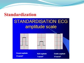 Standardization
 