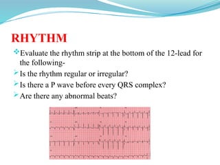 RHYTHM
Evaluate the rhythm strip at the bottom of the 12-lead for
the following-
Is the rhythm regular or irregular?
Is there a P wave before every QRS complex?
Are there any abnormal beats?
 