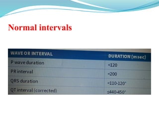 Normal intervals
 