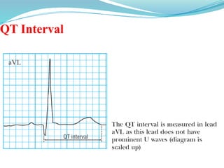QT Interval
 
