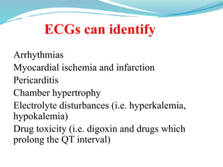 ECGs can identify
Arrhythmias
Myocardial ischemia and infarction
Pericarditis
Chamber hypertrophy
Electrolyte disturbances (i.e. hyperkalemia,
hypokalemia)
Drug toxicity (i.e. digoxin and drugs which
prolong the QT interval)
 