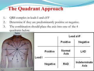 The Quadrant Approach
1. QRS complex in leads I and aVF
2. Determine if they are predominantly positive or negative.
3. The combination should place the axis into one of the 4
quadrants below.
 