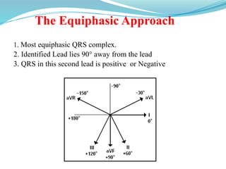 The Equiphasic Approach
1. Most equiphasic QRS complex.
2. Identified Lead lies 90° away from the lead
3. QRS in this second lead is positive or Negative
 