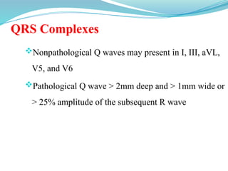 QRS Complexes
Non­
pathological Q waves may present in I, III, aVL,
V5, and V6
Pathological Q wave > 2mm deep and > 1mm wide or
> 25% amplitude of the subsequent R wave
 
