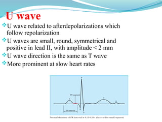 U wave
U wave related to afterdepolarizations which
follow repolarization
U waves are small, round, symmetrical and
positive in lead II, with amplitude < 2 mm
U wave direction is the same as T wave
More prominent at slow heart rates
 