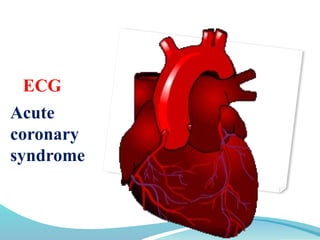ECG
Acute
coronary
syndrome
 