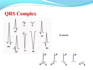 Basics of Electrocardiography(ECG) | PPT