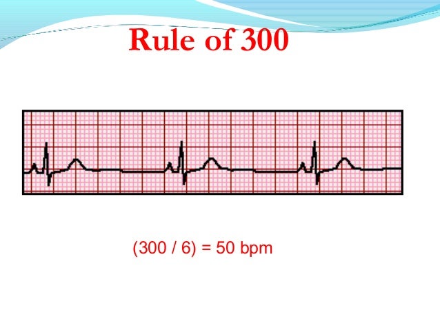 Basics Of Electrocardiography Ecg