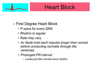 Heart Block
– First Degree Heart Block
• P-wave for every QRS
• Rhythm is regular
• Rate may vary
• Av Node hold each impulse longer than normal
before conducting normally through the
ventricles
• Prolonged PR interval
– Looks just like normal sinus rhythm
 