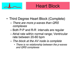 Heart Block
• Third Degree Heart Block (Complete)
– There are more p-waves than QRS
complexes
– Both P-P and R-R intervals are regular
– Atrial rate within normal range; Ventricular
rate between 20-60 bpm
– The block at the AV node is complete
• There is no relationship between the p-waves
and QRS complexes
 
