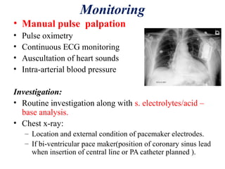Monitoring
• Manual pulse palpation
• Pulse oximetry
• Continuous ECG monitoring
• Auscultation of heart sounds
• Intra-arterial blood pressure
Investigation:
• Routine investigation along with s. electrolytes/acid –
base analysis.
• Chest x-ray:
– Location and external condition of pacemaker electrodes.
– If bi-ventricular pace maker(position of coronary sinus lead
when insertion of central line or PA catheter planned ).
 
