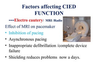 Factors affecting CIED
FUNCTION
---Electro cautery/ MRI /Radio frequency ablation
Effect of MRI on pacemaker
• Inhibition of pacing
• Asynchronous pacing
• Inappropriate defibrillation /complete device
failure
• Shielding reduces problems now a days.
 