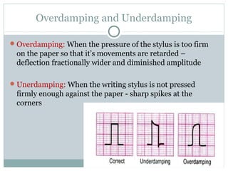 Overdamping and Underdamping
Overdamping: When the pressure of the stylus is too firm
on the paper so that it’s movements are retarded –
deflection fractionally wider and diminished amplitude
Unerdamping: When the writing stylus is not pressed
firmly enough against the paper - sharp spikes at the
corners
 