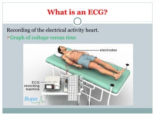 What is an ECG?
Recording of the electrical activity heart.
Graph of voltage versus time
 