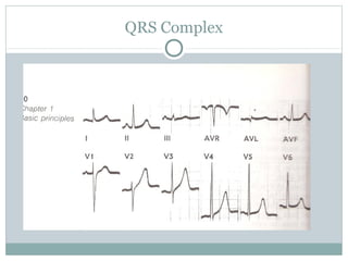 QRS Complex
 