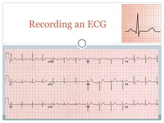 Recording an ECG
 