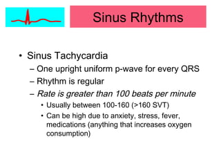 • Sinus Tachycardia
– One upright uniform p-wave for every QRS
– Rhythm is regular
– Rate is greater than 100 beats per minute
• Usually between 100-160 (>160 SVT)
• Can be high due to anxiety, stress, fever,
medications (anything that increases oxygen
consumption)
Sinus Rhythms
 