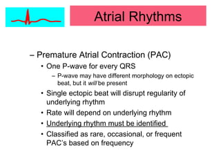 – Premature Atrial Contraction (PAC)
• One P-wave for every QRS
– P-wave may have different morphology on ectopic
beat, but it will be present
• Single ectopic beat will disrupt regularity of
underlying rhythm
• Rate will depend on underlying rhythm
• Underlying rhythm must be identified
• Classified as rare, occasional, or frequent
PAC’s based on frequency
Atrial Rhythms
 