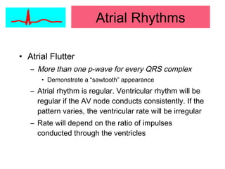 • Atrial Flutter
– More than one p-wave for every QRS complex
• Demonstrate a “sawtooth” appearance
– Atrial rhythm is regular. Ventricular rhythm will be
regular if the AV node conducts consistently. If the
pattern varies, the ventricular rate will be irregular
– Rate will depend on the ratio of impulses
conducted through the ventricles
Atrial Rhythms
 