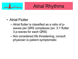 Atrial Rhythms
• Atrial Flutter
– Atrial flutter is classified as a ratio of p-
waves per QRS complexes (ex: 3:1 flutter
3 p-waves for each QRS)
– Not considered life threatening, consult
physician is patient symptomatic
 