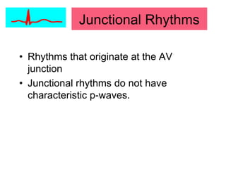 • Rhythms that originate at the AV
junction
• Junctional rhythms do not have
characteristic p-waves.
Junctional Rhythms
 