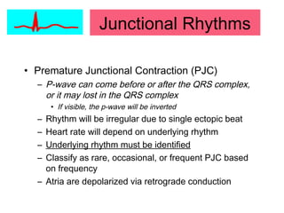 • Premature Junctional Contraction (PJC)
– P-wave can come before or after the QRS complex,
or it may lost in the QRS complex
• If visible, the p-wave will be inverted
– Rhythm will be irregular due to single ectopic beat
– Heart rate will depend on underlying rhythm
– Underlying rhythm must be identified
– Classify as rare, occasional, or frequent PJC based
on frequency
– Atria are depolarized via retrograde conduction
Junctional Rhythms
 