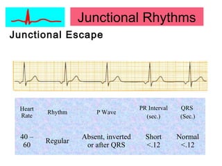 Junctional Rhythms
Junctional Escape
Heart
Rate
Rhythm P Wave
PR Interval
(sec.)
QRS
(Sec.)
40 –
60
Regular
Absent, inverted
or after QRS
Short
<.12
Normal
<.12
 