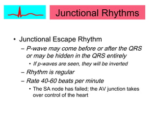 Junctional Rhythms
• Junctional Escape Rhythm
– P-wave may come before or after the QRS
or may be hidden in the QRS entirely
• If p-waves are seen, they will be inverted
– Rhythm is regular
– Rate 40-60 beats per minute
• The SA node has failed; the AV junction takes
over control of the heart
 