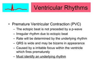Ventricular Rhythms
• Premature Ventricular Contraction (PVC)
– The ectopic beat is not preceded by a p-wave
– Irregular rhythm due to ectopic beat
– Rate will be determined by the underlying rhythm
– QRS is wide and may be bizarre in appearance
– Caused by a irritable focus within the ventricle
which fires prematurely
– Must identify an underlying rhythm
 