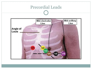 Precordial Leads
 