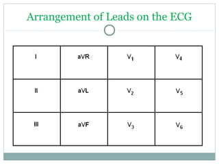 Arrangement of Leads on the ECG
 