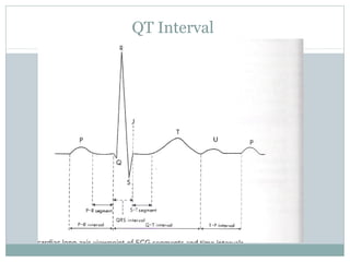 QT Interval
 
