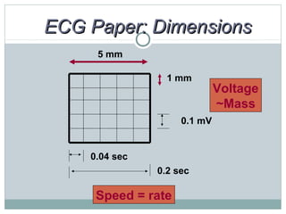 ECG Paper: DimensionsECG Paper: Dimensions
5 mm
1 mm
0.1 mV
0.04 sec
0.2 sec
Speed = rate
Voltage
~Mass
 