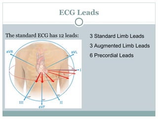 ECG Leads
The standard ECG has 12 leads: 3 Standard Limb Leads
3 Augmented Limb Leads
6 Precordial Leads
 