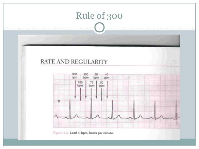 Basics Of Ecg Basics Of Ecg