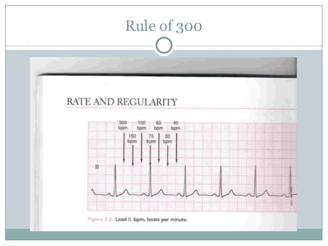 Basics Of Ecg