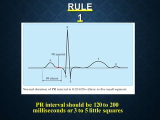 Basics of ecg | PPTX